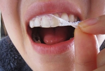 Top 5 Miếng dán trắng răng loại nào tốt nhất được tin dùng